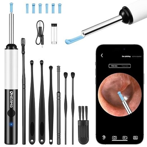 Otoscopio endoscopio digitale - endoscopio,