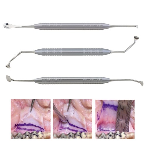 Wen set pettine - set, rilascio