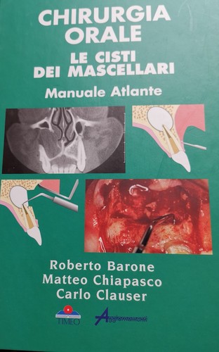 Chirurgia orale cisti dei - chirurgia, le