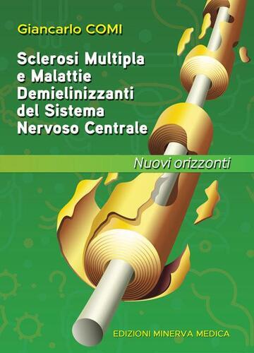Sclerosi multipla malattie - sclerosi,