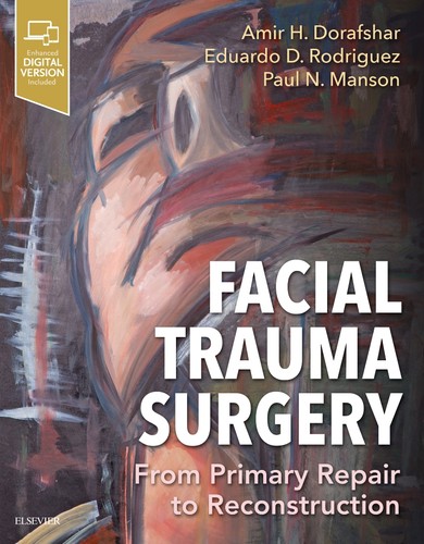 Facial trauma surgery - facial,