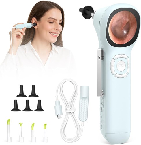 Videocamera otoscopio