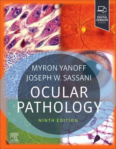 Ocular pathology - ocular,