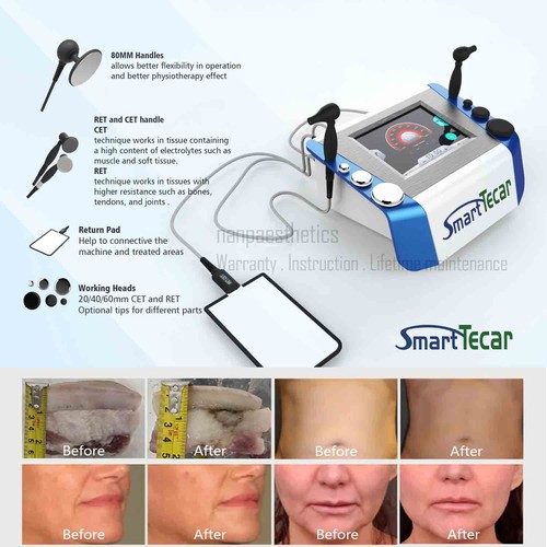 Macchina per fisioterapia