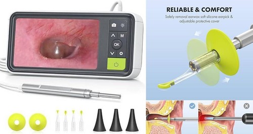 Otoscopio digitale con
