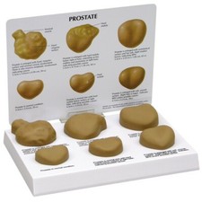 Modello anatomico prostatico