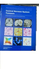 Tumori Del Sistema Nervoso