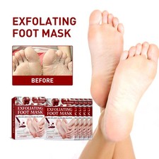 Deep Exfoliating Glycolic Acid