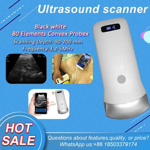 Scanner ultrasuoni wireless - scanner,