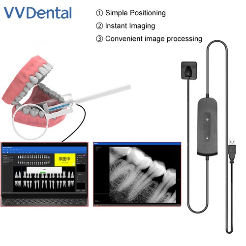 Sensore rvg dentale - rvg,