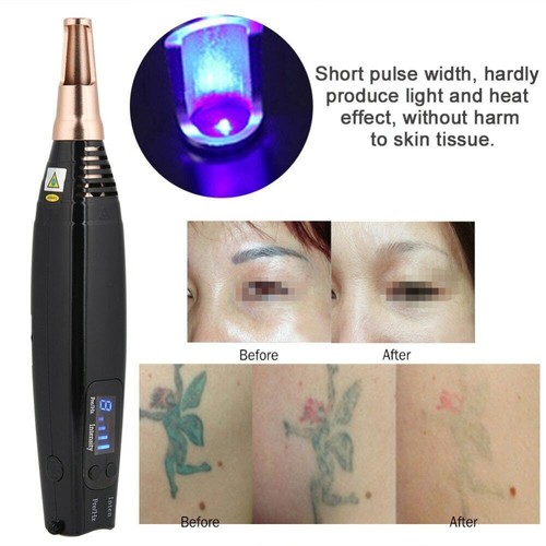 Penna laser portatile