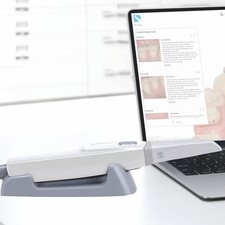 Scanner intraorale dentale