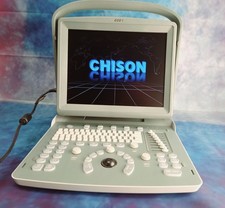 Ecografo portatile CHISON ECO1