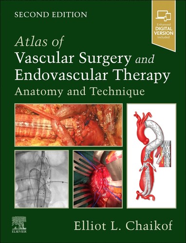 Atlas vascular surgery and - of,