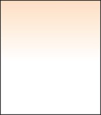 Lee Filters SW150 Corallo 4