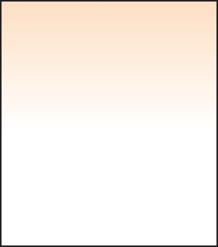 Lee filters sw150 - lee,