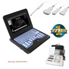 Scanner ultrasuoni portatile