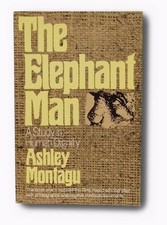 The Elephant Man: A Study in
