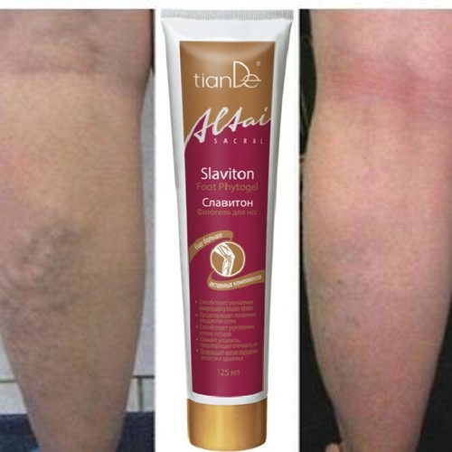 Crema gambe vene varicose gel - vene,