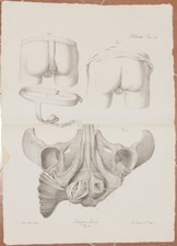 ANTONIO SCARPA 1839 LITOGRAFIA MEDICINA CHIRURGIA ANATOMIA DIVERSO TIPO DI ERNIA