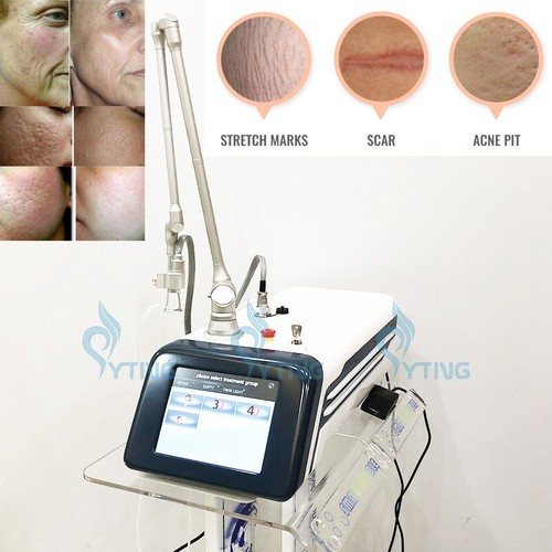 Macchina laser frazionaria - , co2