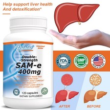 SAM-e 400mg - Cervello E