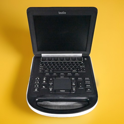Sistema ecografico portatile - sistema,