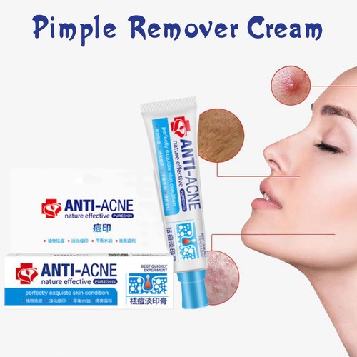 Top crema acne - , anti