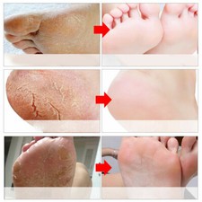 Exfoliating Foot Peeling Mask