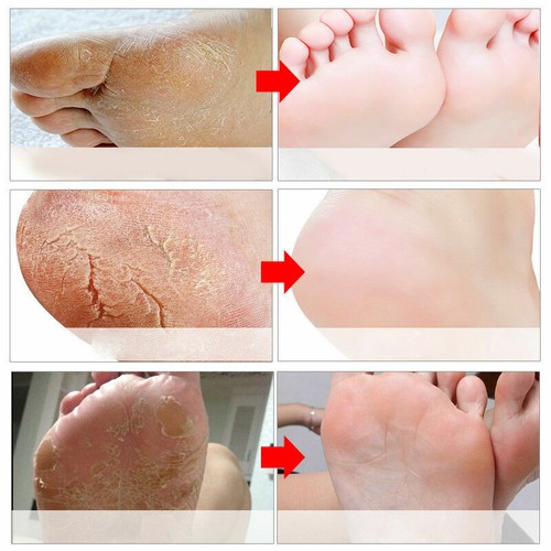 Maschera esfoliante peeling