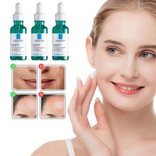 LaRo*cheP|o$ay Effaclar siero