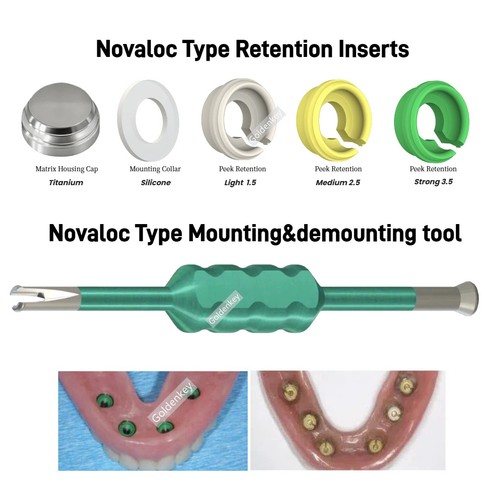 Inserti ritenzione dentale - di,