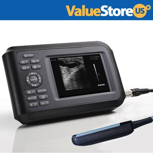 Scanner ultrasuoni portatile - ultrasuoni,