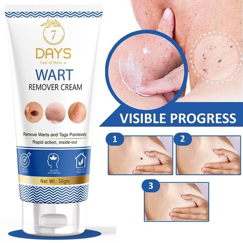Crema per trattamento di - il,