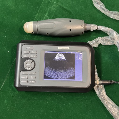 Scanner ultrasuoni portatile - ultrasuoni,