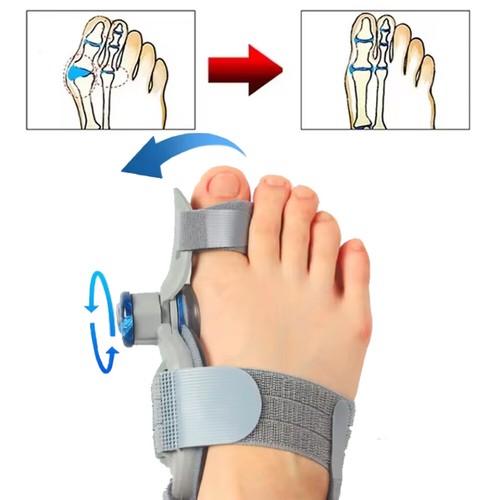 Terapia correttore alce - correttore,