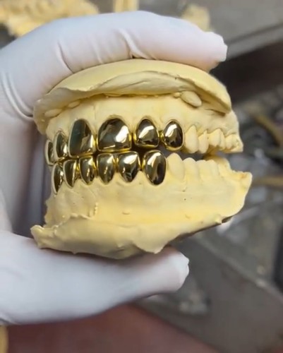 Griglia oro 14k personalizzata