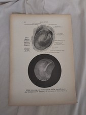 Stampa Anatomica Medica Organo
