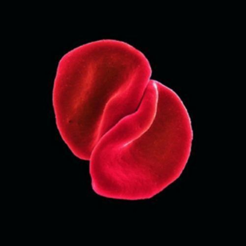 Peter gabriel scratch back - scratch, my