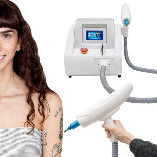 Yag laser rimozione - yag,
