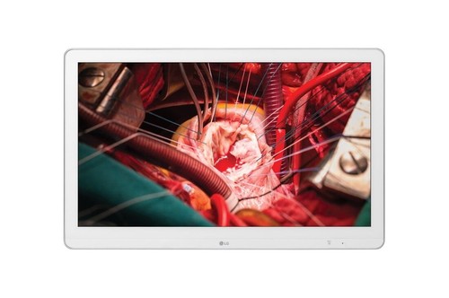 Monitor medico lg - hd, 27"