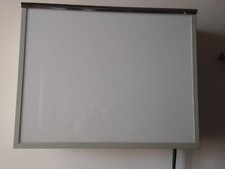 Diafanoscopio strumento per la diagnosi