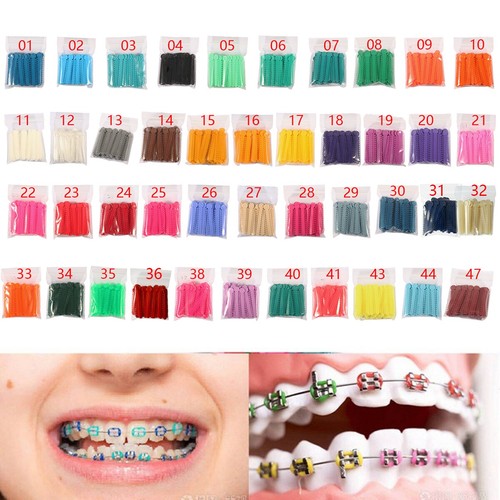 1040 legature ortodontiche - 1040,
