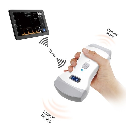 Scanner ultrasuoni wireless - scanner,