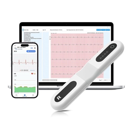 Er1 ecg holter - ecg, portatile