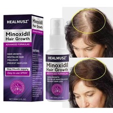 Minoxidil 2% Extra Forza