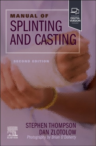 Manual splinting casting - splinting, &