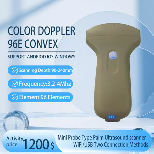 Scanner sonda ultrasuoni