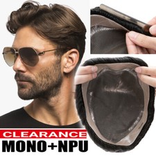 Parrucca uomo sistema di