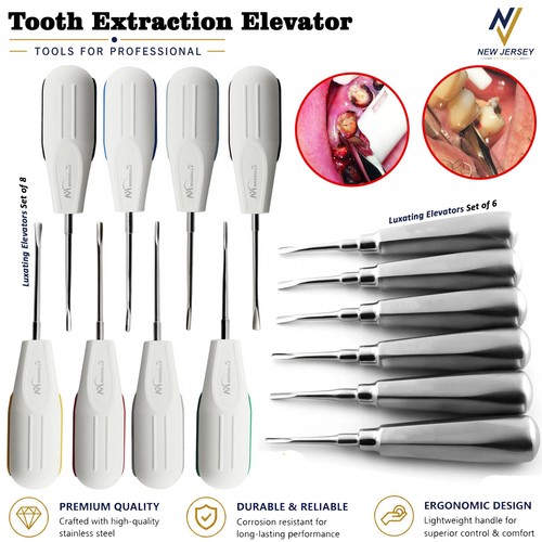 Lussazione dentale - lussazione,